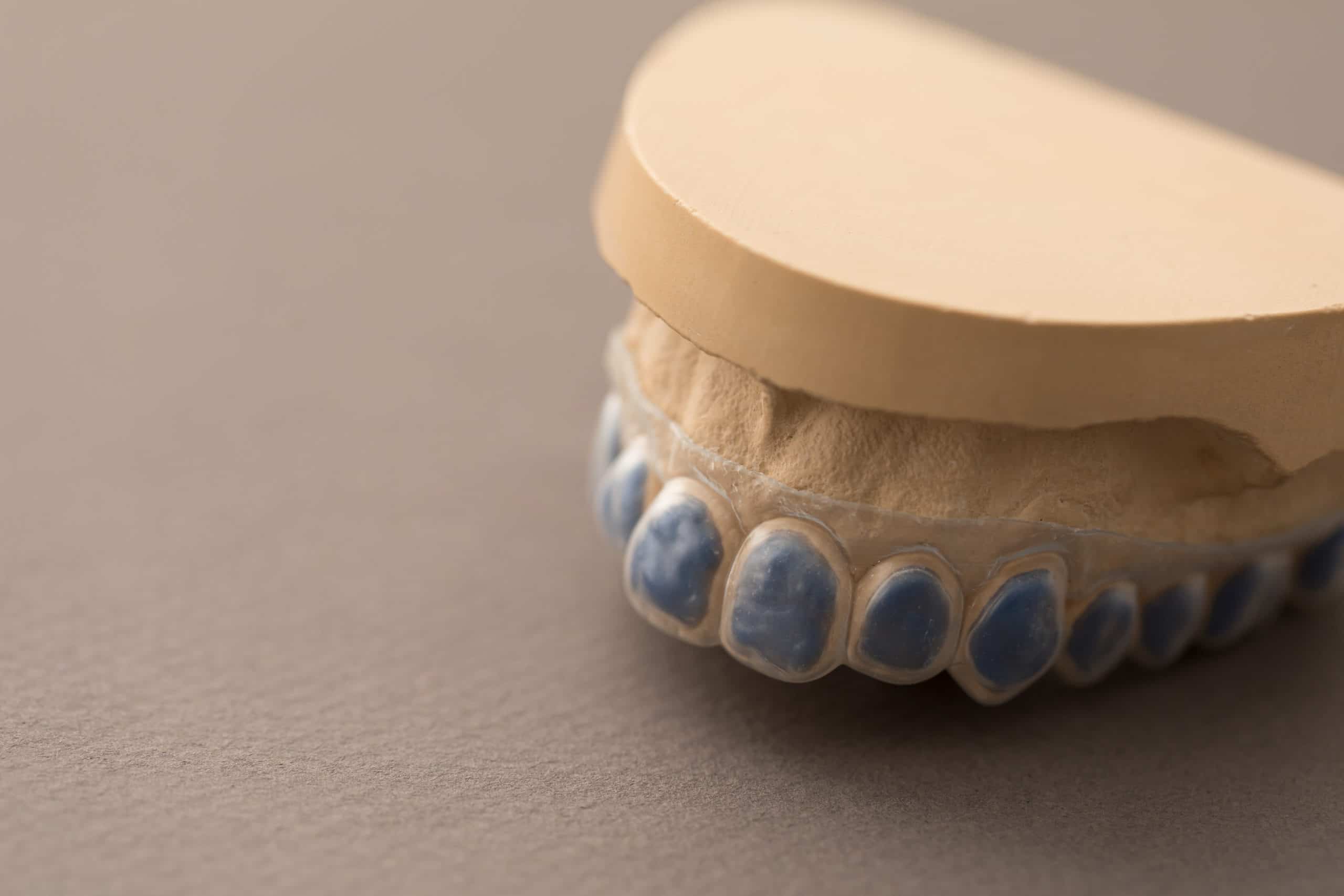 Protège-dents sur mesure – orthogem-lab