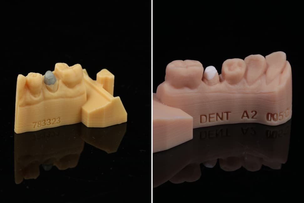 Protège dents - Laboratoire de prothèses dentaires Crown Ceram